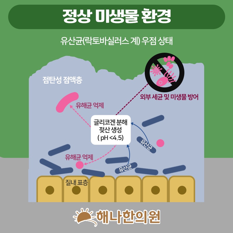 질염 관리의 기본, 질 내 유익균 균형 살피기