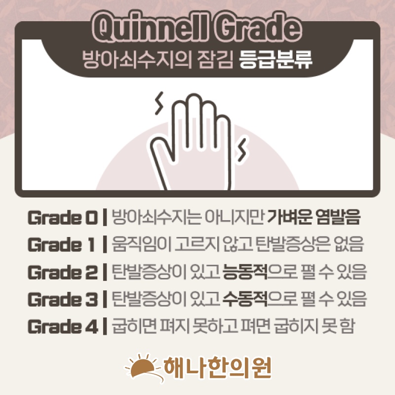 손가락을 움직일 때 딸깍거리고 아픈 방아쇠수지 증상